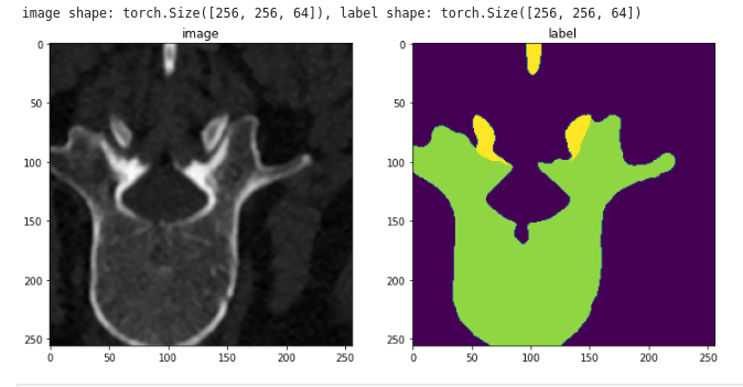 Monai spine training image