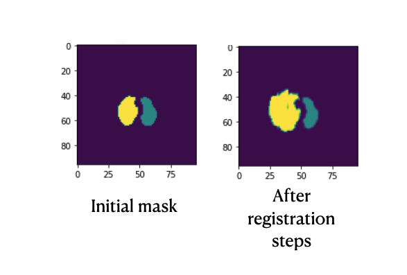 deep learning registration changes